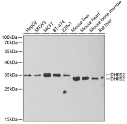 Anti-DHRS2 antibody used in Western Blot (WB). GTX33152