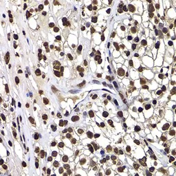 Anti-DNAJB6 antibody used in IHC (Paraffin sections) (IHC-P). GTX33160