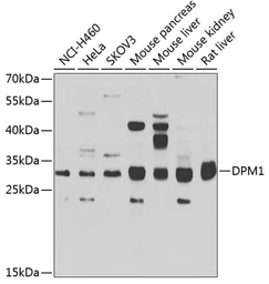 Anti-DPM1 antibody used in Western Blot (WB). GTX33163