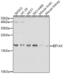Anti-EIF1A antibody used in Western Blot (WB). GTX33170