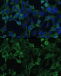 Anti-EIF1A antibody used in Immunocytochemistry/ Immunofluorescence (ICC/IF). GTX33170