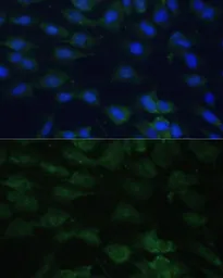 Anti-EIF1A antibody used in Immunocytochemistry/ Immunofluorescence (ICC/IF). GTX33170