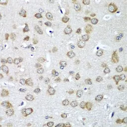 Anti-EIF1A antibody used in IHC (Paraffin sections) (IHC-P). GTX33170