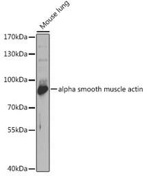Anti-EZH1 antibody used in Western Blot (WB). GTX33188