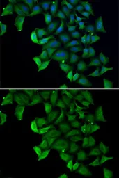 Anti-FABP5 antibody used in Immunocytochemistry/ Immunofluorescence (ICC/IF). GTX33191