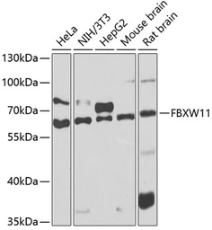 Anti-FBXW11 antibody used in Western Blot (WB). GTX33193