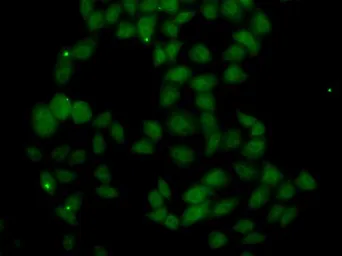 Anti-FGF14 antibody used in Immunocytochemistry/ Immunofluorescence (ICC/IF). GTX33198