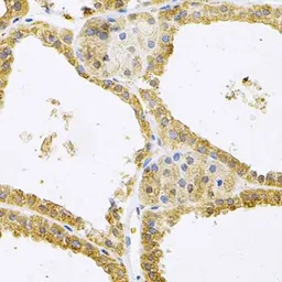 Anti-FHL1 antibody used in IHC (Paraffin sections) (IHC-P). GTX33199