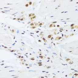 Anti-GABPB1 antibody used in IHC (Paraffin sections) (IHC-P). GTX33210