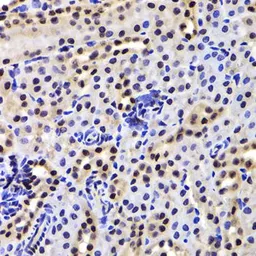 Anti-GABPB1 antibody used in IHC (Paraffin sections) (IHC-P). GTX33210