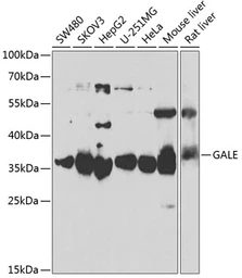 Anti-GALE antibody used in Western Blot (WB). GTX33212