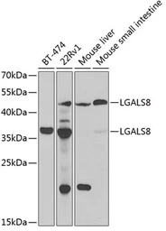 Anti-Galectin 8 antibody used in Western Blot (WB). GTX33214