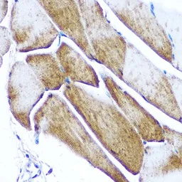 Anti-GLUT4 antibody used in IHC (Paraffin sections) (IHC-P). GTX33221