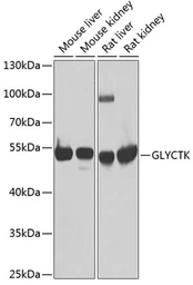 Anti-GLYCTK antibody used in Western Blot (WB). GTX33222