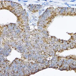 Anti-GRPEL2 antibody used in IHC (Paraffin sections) (IHC-P). GTX33230