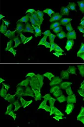 Anti-HAGH antibody used in Immunocytochemistry/ Immunofluorescence (ICC/IF). GTX33234