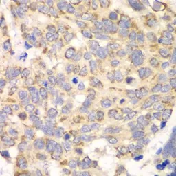 Anti-HAGH antibody used in IHC (Paraffin sections) (IHC-P). GTX33234