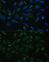 Anti-HCCS antibody used in Immunocytochemistry/ Immunofluorescence (ICC/IF). GTX33236