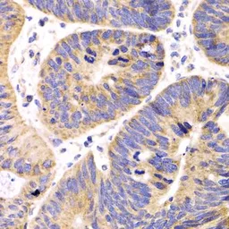 Anti-HMGCL antibody used in IHC (Paraffin sections) (IHC-P). GTX33242