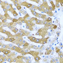 Anti-IFIT3 antibody used in IHC (Paraffin sections) (IHC-P). GTX33255