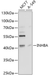 Anti-Inhibin beta A antibody used in Western Blot (WB). GTX33267