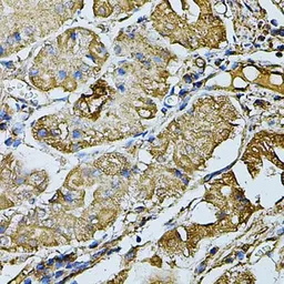 Anti-K-Cadherin antibody used in IHC (Paraffin sections) (IHC-P). GTX33279