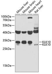 Anti-Kallikrein 10 antibody used in Western Blot (WB). GTX33280