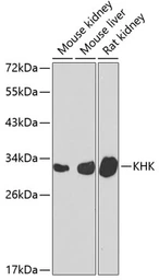 Anti-Ketohexokinase antibody used in Western Blot (WB). GTX33283