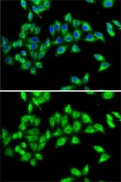 Anti-KIF3A antibody used in Immunocytochemistry/ Immunofluorescence (ICC/IF). GTX33287