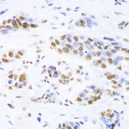 Anti-Ku80 antibody used in IHC (Paraffin sections) (IHC-P). GTX33290