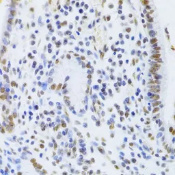 Anti-Ku80 antibody used in IHC (Paraffin sections) (IHC-P). GTX33290