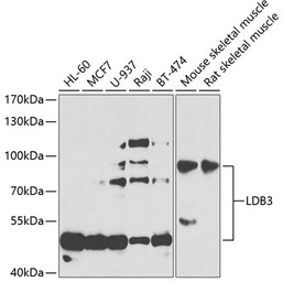 Anti-LDB3 antibody used in Western Blot (WB). GTX33294