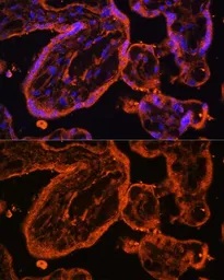 Anti-LDB3 antibody used in IHC (Paraffin sections) (IHC-P). GTX33294