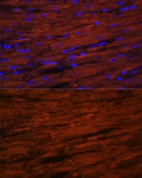 Anti-LDB3 antibody used in IHC (Paraffin sections) (IHC-P). GTX33294