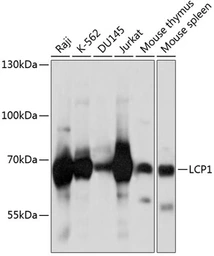 Anti-L-Plastin antibody used in Western Blot (WB). GTX33300