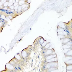 Anti-LRG1 antibody used in IHC (Paraffin sections) (IHC-P). GTX33301
