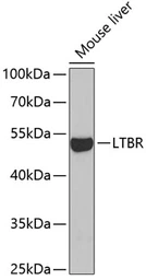 Anti-LTBR antibody used in Western Blot (WB). GTX33305