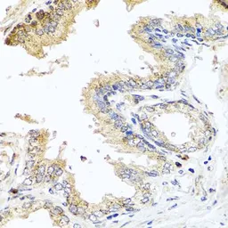 Anti-MCCC2 antibody used in IHC (Paraffin sections) (IHC-P). GTX33308