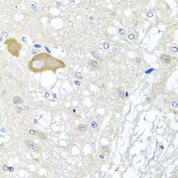 Anti-MCCC2 antibody used in IHC (Paraffin sections) (IHC-P). GTX33308