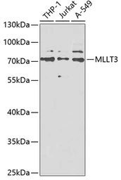 Anti-AF9 antibody used in Western Blot (WB). GTX33320