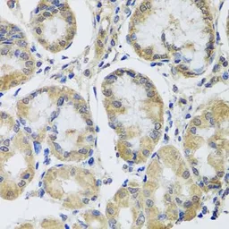 Anti-MRPL1 antibody used in IHC (Paraffin sections) (IHC-P). GTX33325