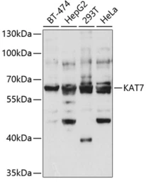Anti-MYST2 antibody used in Western Blot (WB). GTX33341