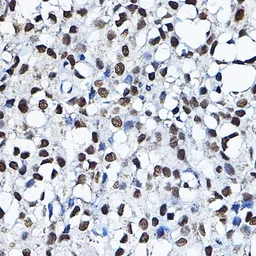 Anti-MYST2 antibody used in IHC (Paraffin sections) (IHC-P). GTX33341