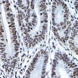 Anti-MYST2 antibody used in IHC (Paraffin sections) (IHC-P). GTX33341