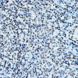 Anti-MYST2 antibody used in IHC (Paraffin sections) (IHC-P). GTX33341