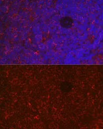 Anti-NFAT1 antibody used in IHC (Paraffin sections) (IHC-P). GTX33354