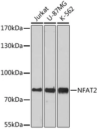 Anti-NFAT2 antibody used in Western Blot (WB). GTX33355