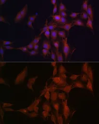 Anti-NFS1 antibody used in Immunocytochemistry/ Immunofluorescence (ICC/IF). GTX33356