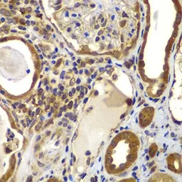Anti-nm23-H2 antibody used in IHC (Paraffin sections) (IHC-P). GTX33360