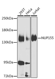 Anti-NUP155 antibody used in Western Blot (WB). GTX33372